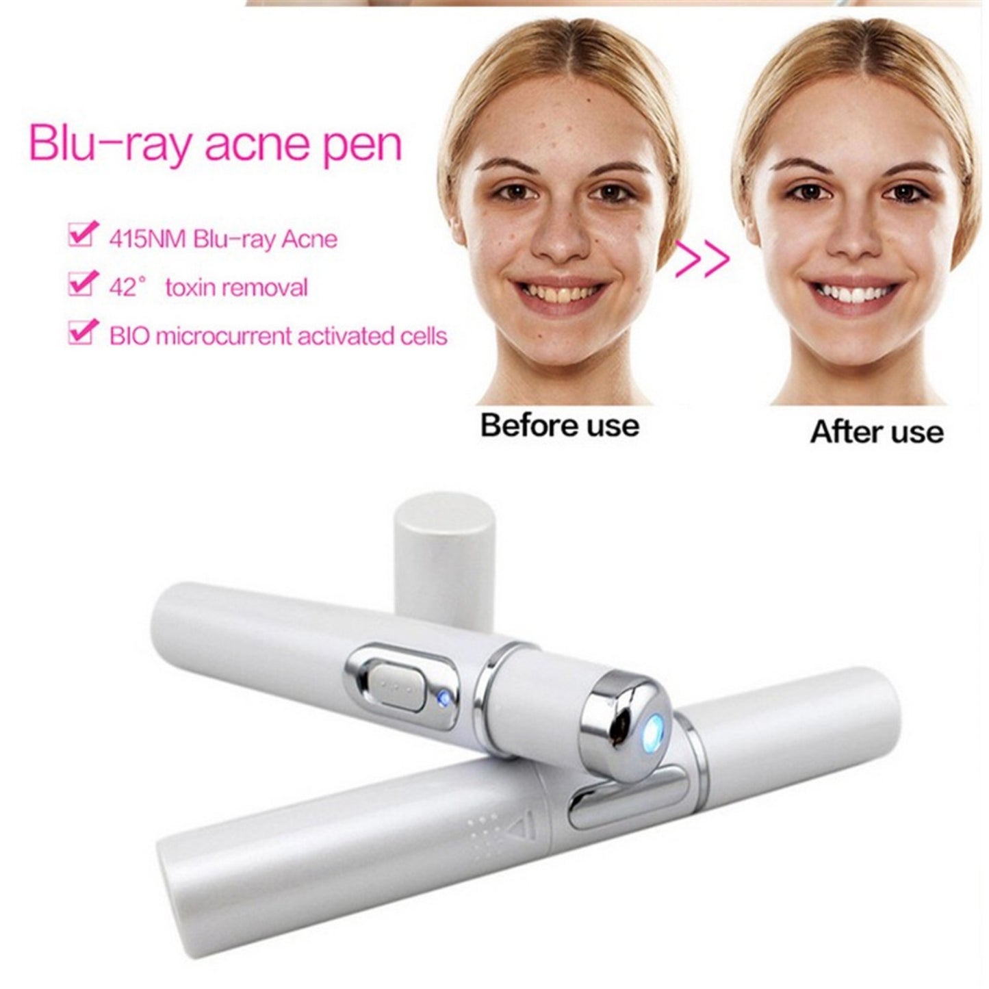 AcneAway Blue Laser Light Pen, Wrinkle Removal Treatment & Skin care Beauty Equipment