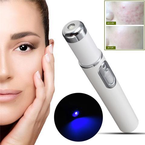 AcneAway Blue Laser Light Pen, Wrinkle Removal Treatment & Skin care Beauty Equipment